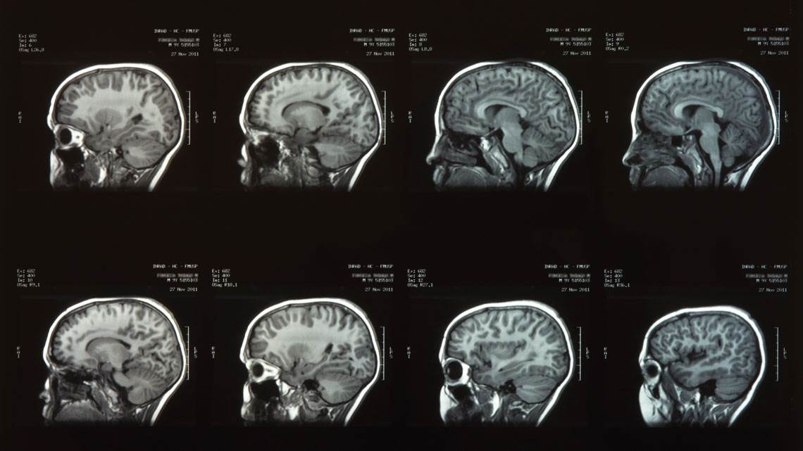 Crecimiento del cerebro humano