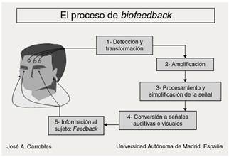 Comparativa de tratamientos neurofeedback