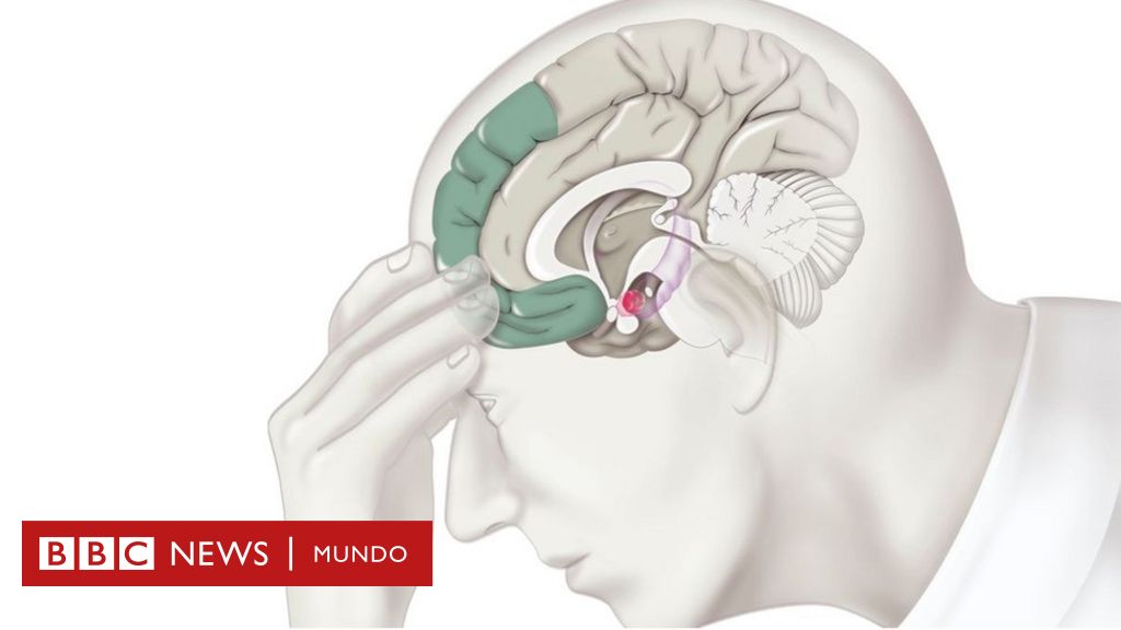 Estrés y cerebro