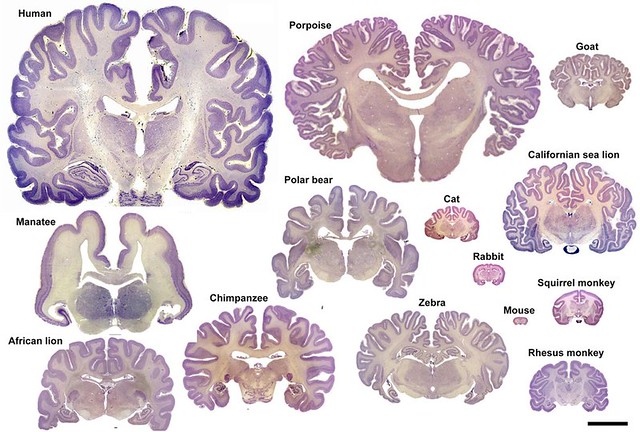 Comparativa inteligencia neurona- cerebro