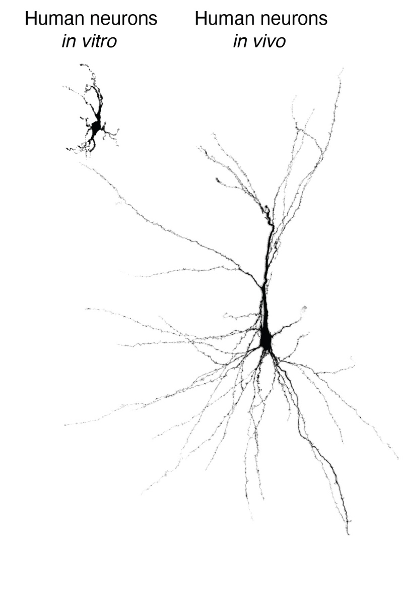 Neuronas y trastornos neuropsiquiátricos