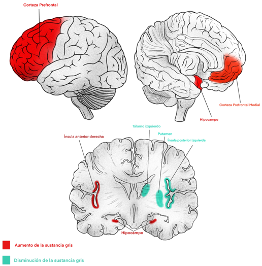 Mindfulness y el cerebro