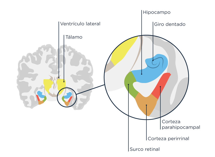 neurona del cerebro de un gato