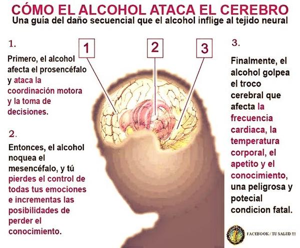 Efectos del alcohol en el cerebro