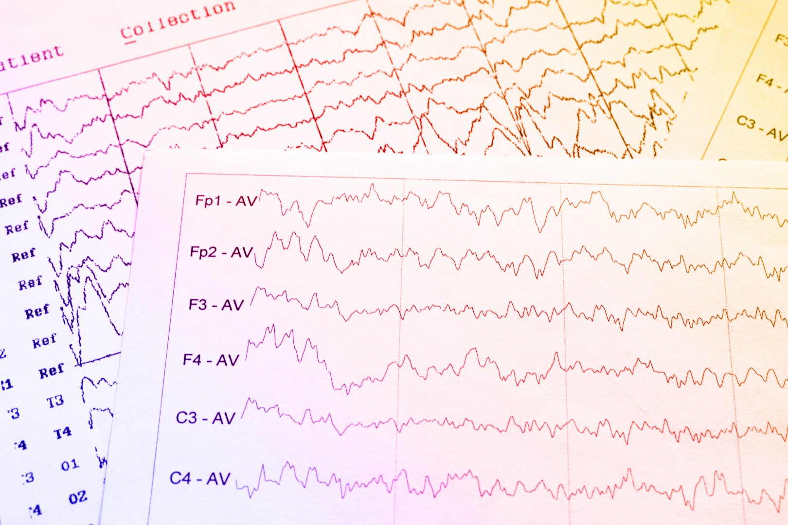 Neurofeedback y mitos desmentidos