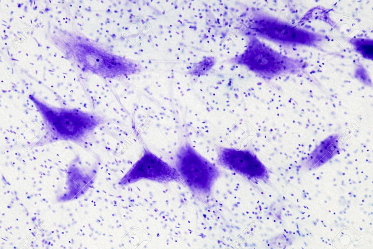 Unas neuronas bajo el microscopio