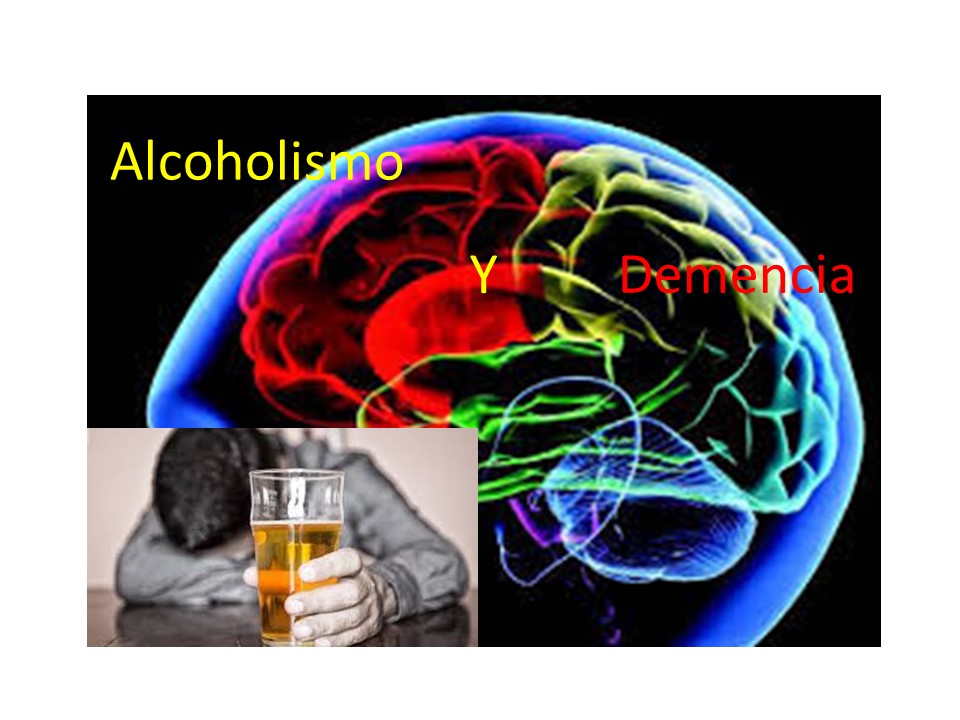Relación alcohol y enfermedades neurodegenerativas