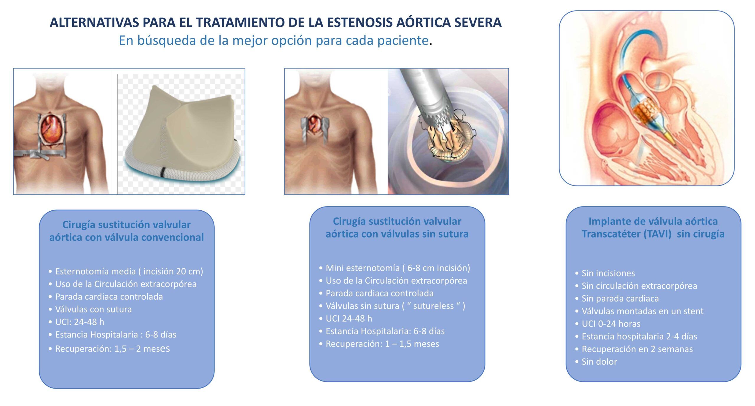 Más opciones de tratamiento alternativas