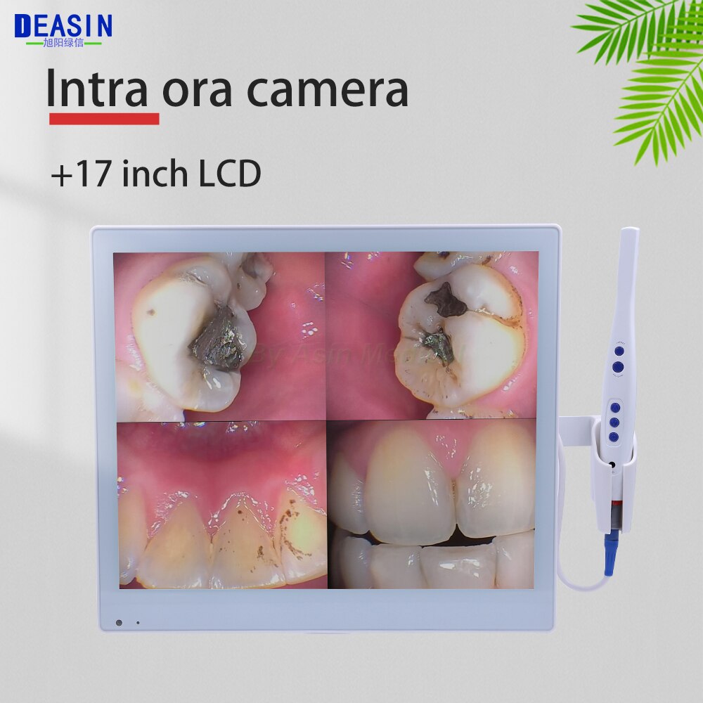 Cámara intraoral en acción