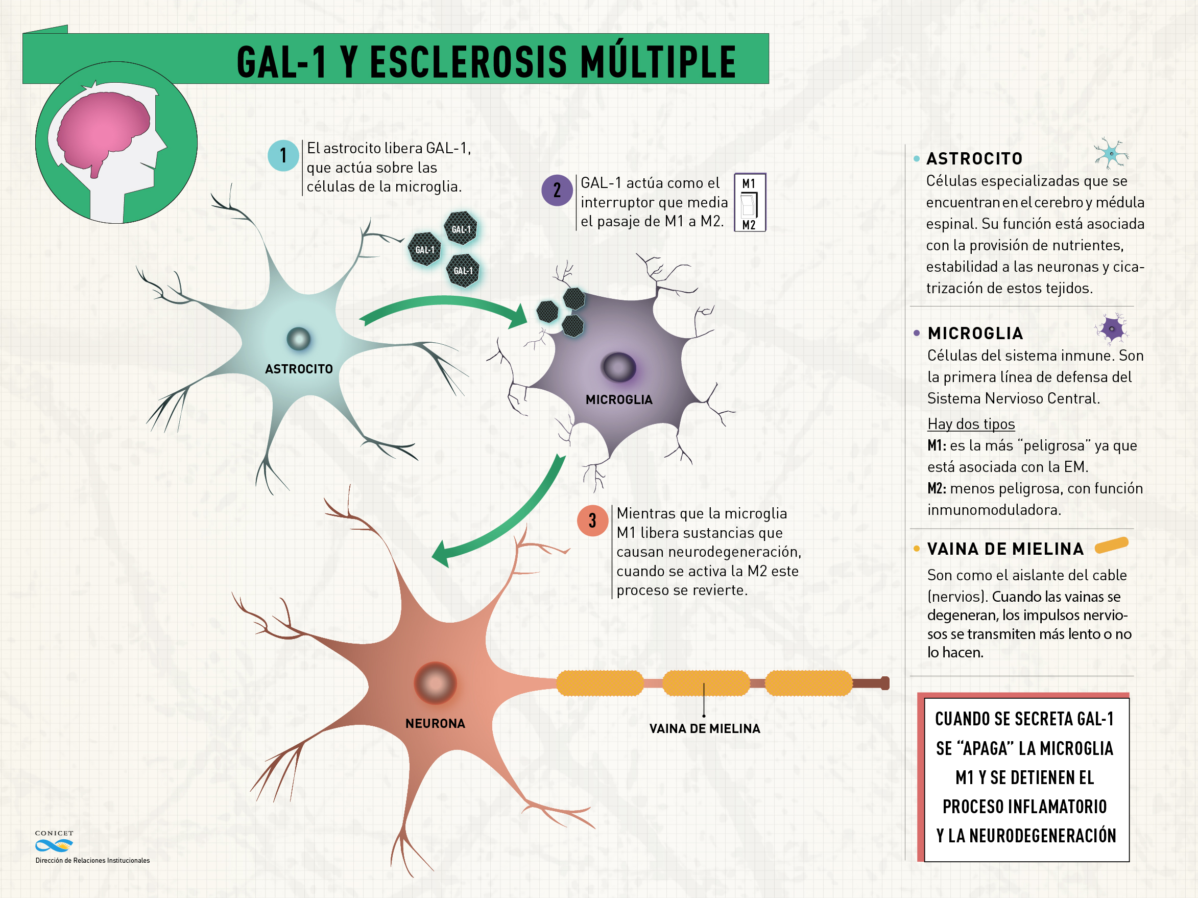 Neuronas en proceso de degeneración