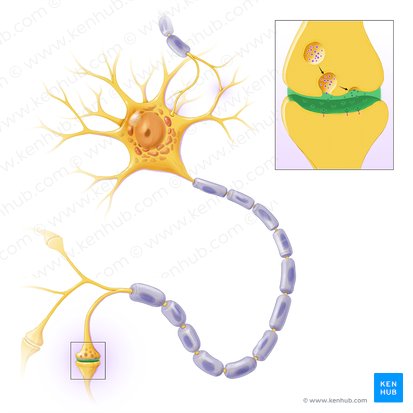 Neuronas dañadas y en proceso de degeneración