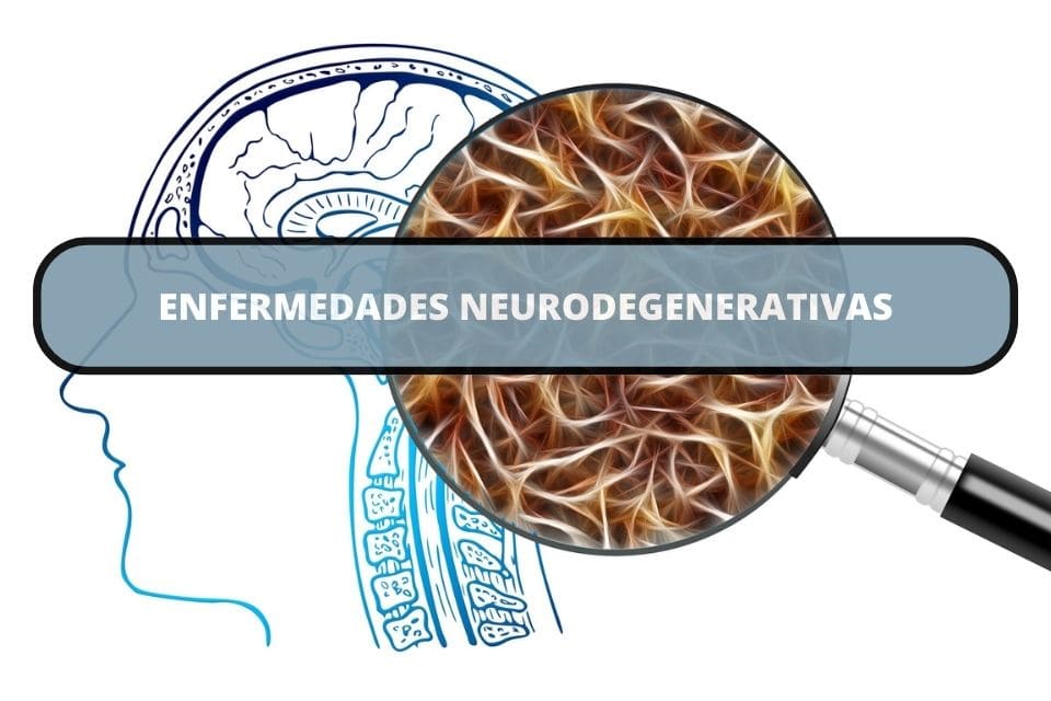 Proceso de neurodegeneración