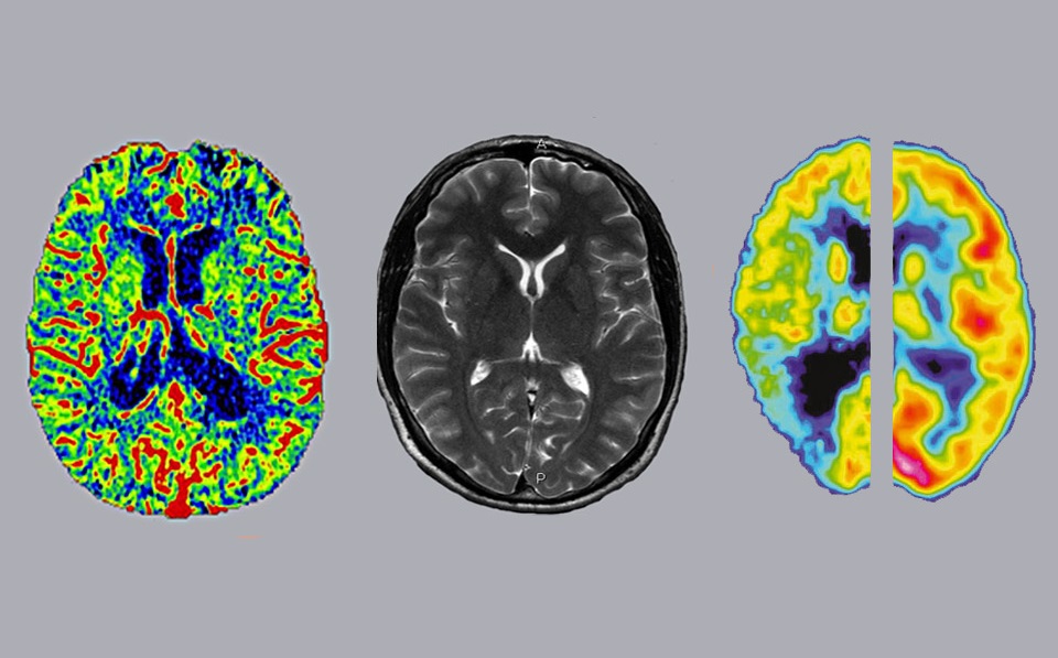 Neuronas y factores ambientales