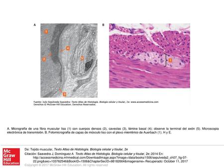 Microscopía de mielinización