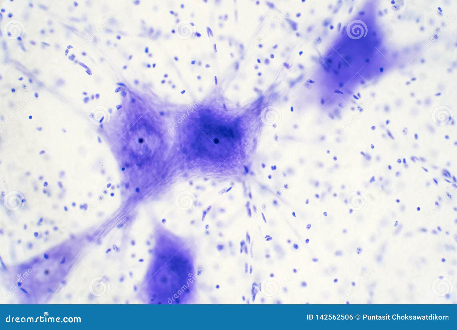 Neuronas en el microscopio