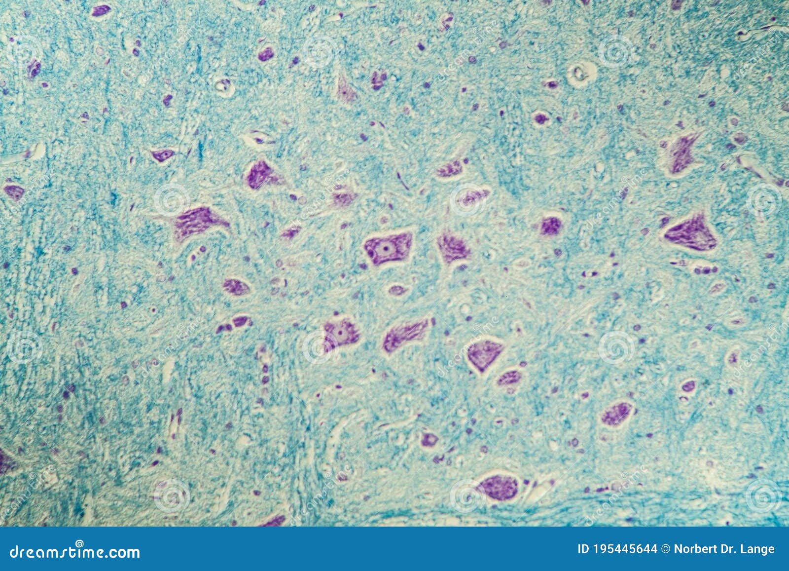 Microscopía de células nerviosas