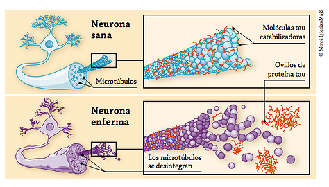 neuronas y envejecimiento