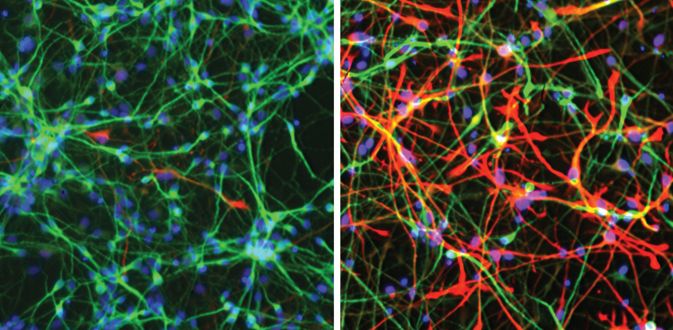 Neuronas en crecimiento