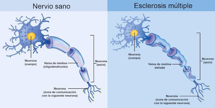 Mielina y neuronas