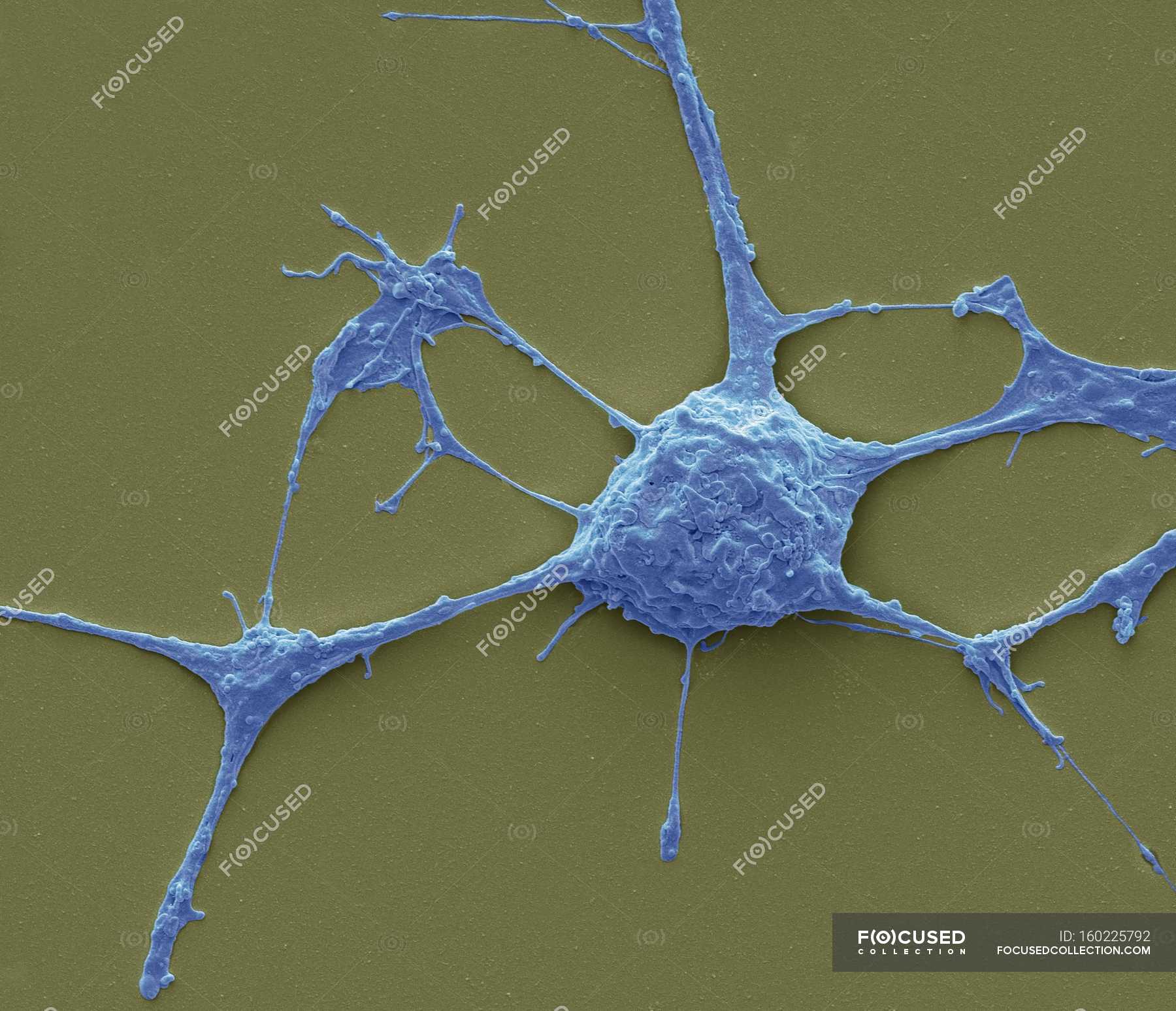 Micrografía de una neurona