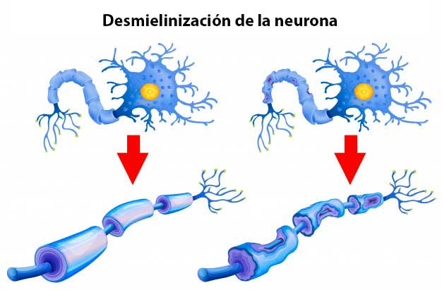 Proceso de formación de mielina