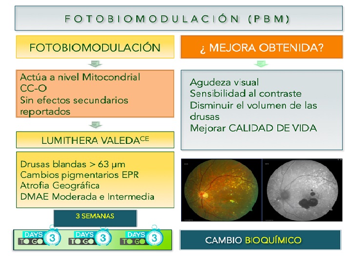 Comparativa visual entre drusas maculares