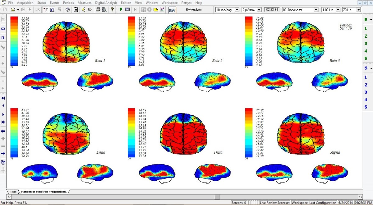 Patrones de actividad cerebral