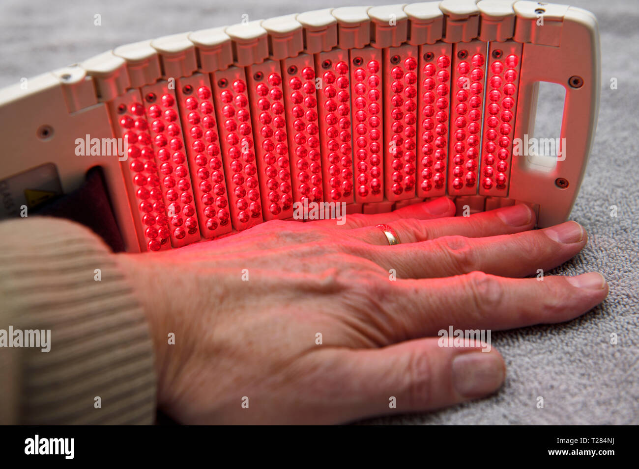 Manos tratadas con luz roja