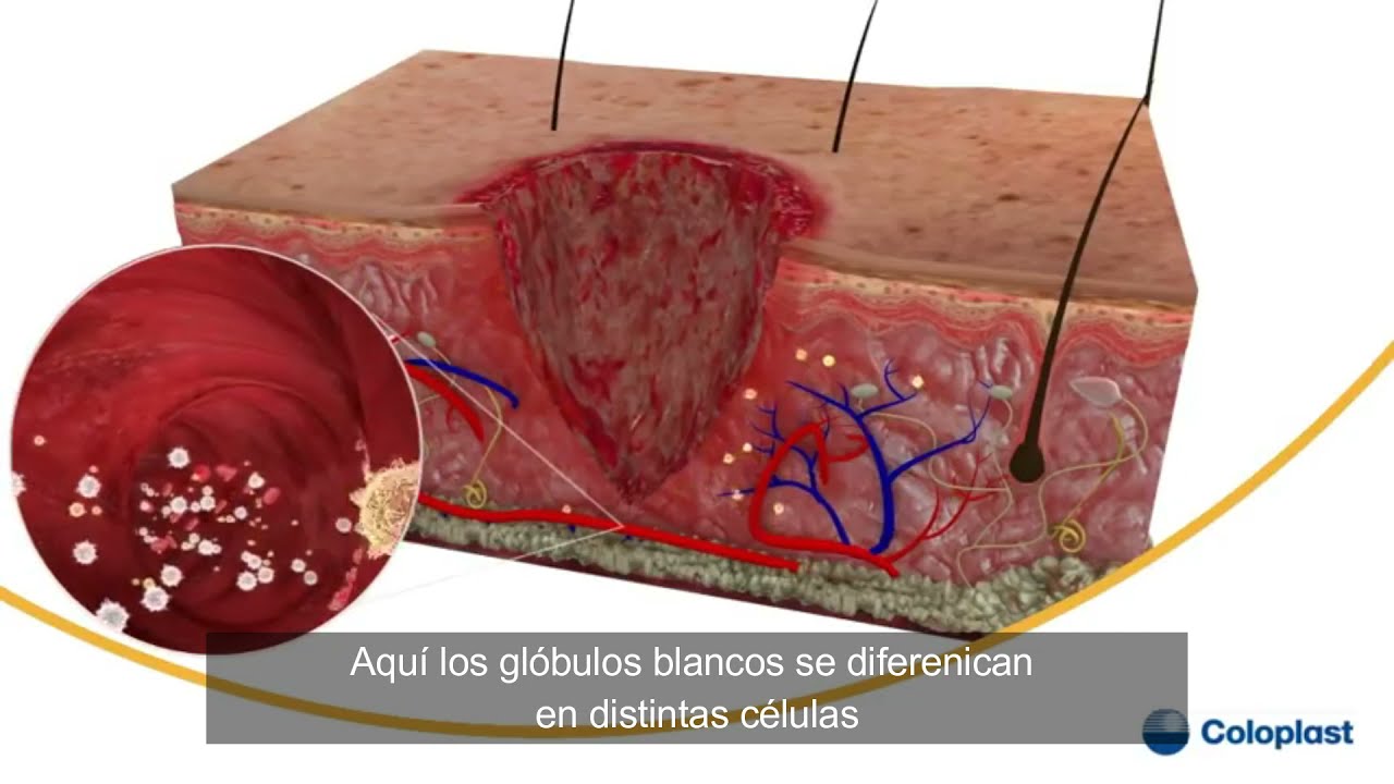 Cicatrización de heridas