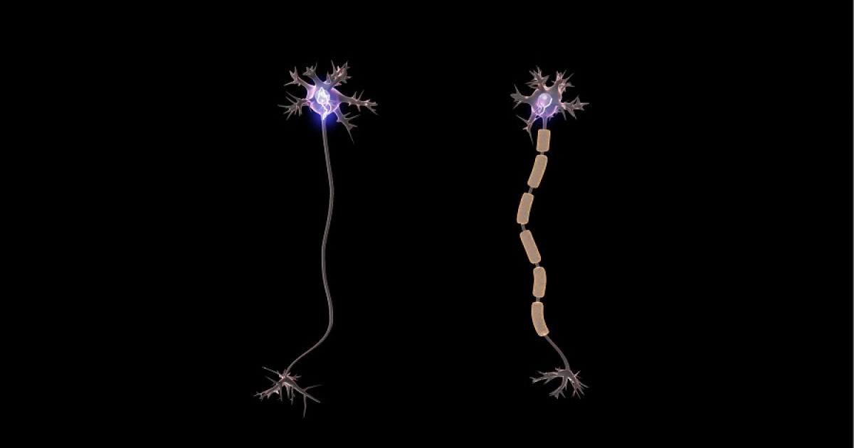 Neuronas en proceso de mielinización