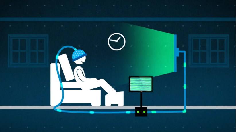 gráfico explicativo del neurofeedback