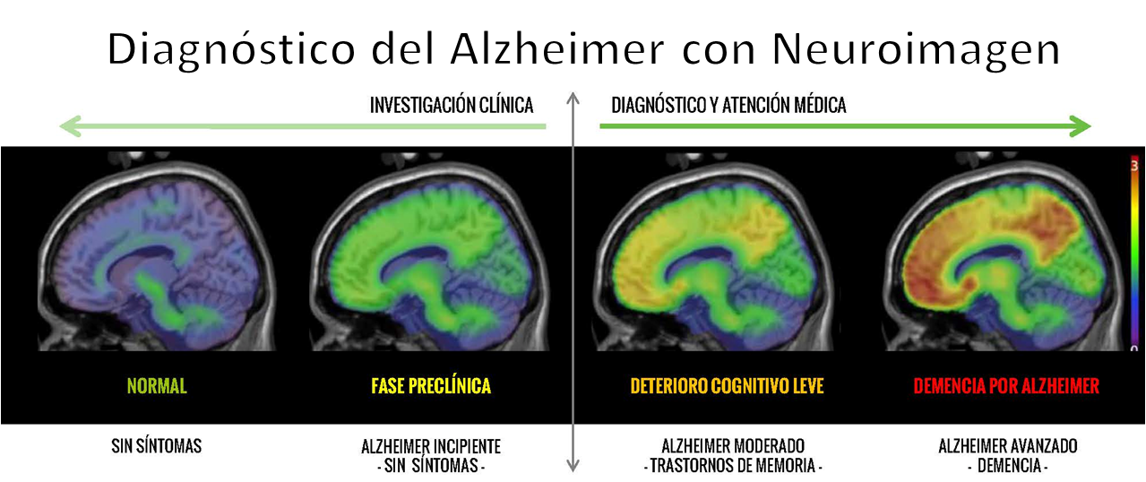 Neuroimagen