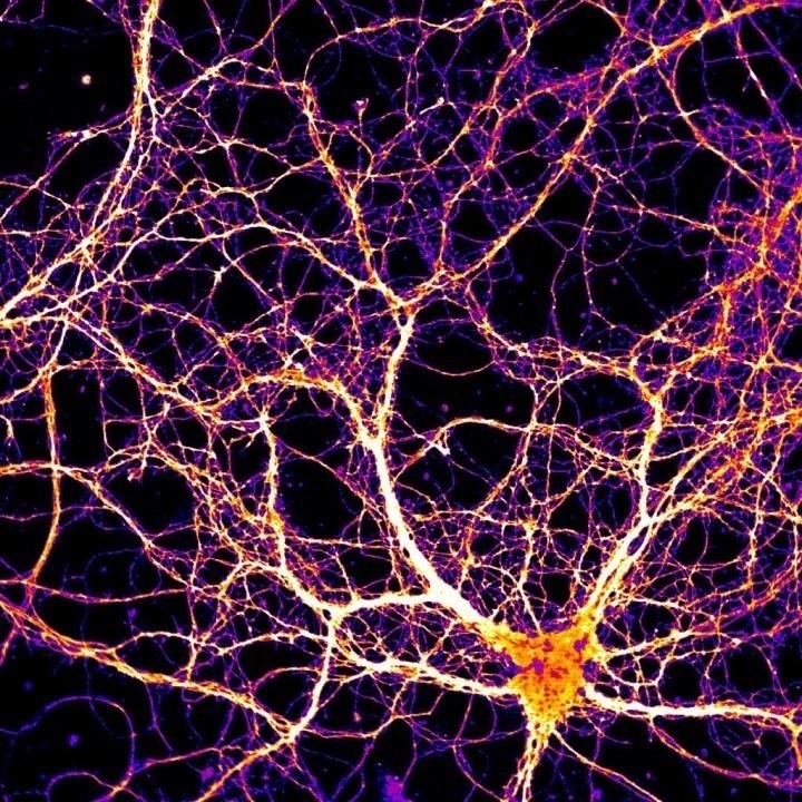 Neuronas y conexiones eléctricas