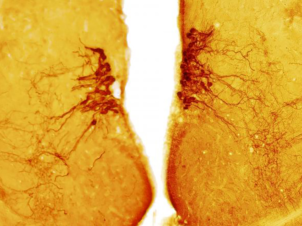Neuronas en cerebro de pez