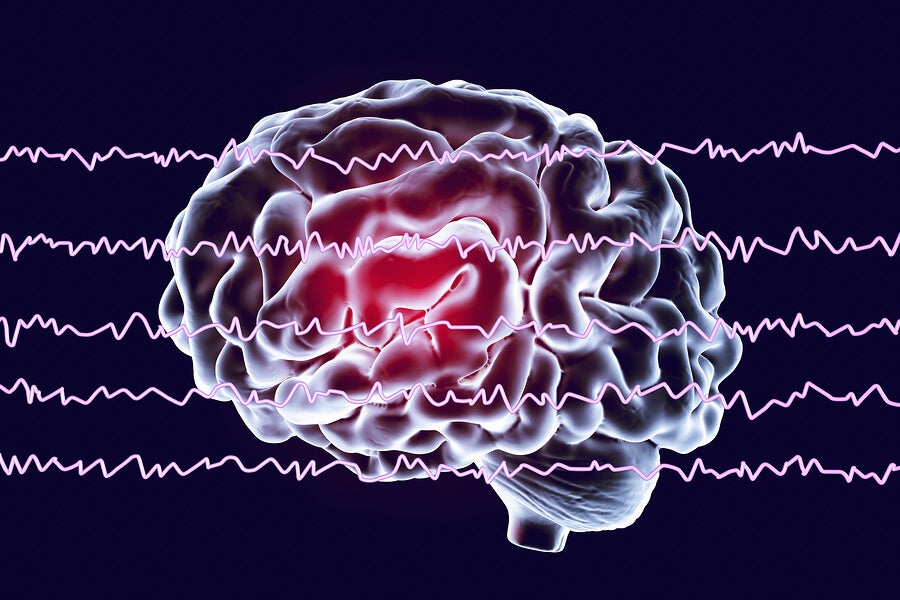 Cerebro y ondas sonoras