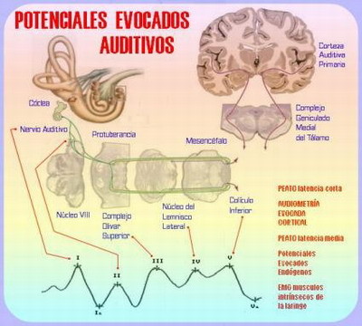 Resultados potenciales del Cerebrak