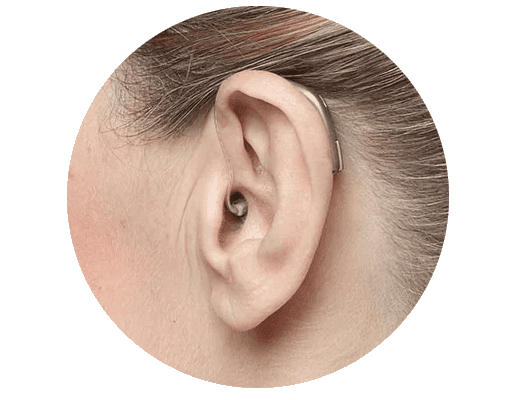 Aparatos auditivos modernos