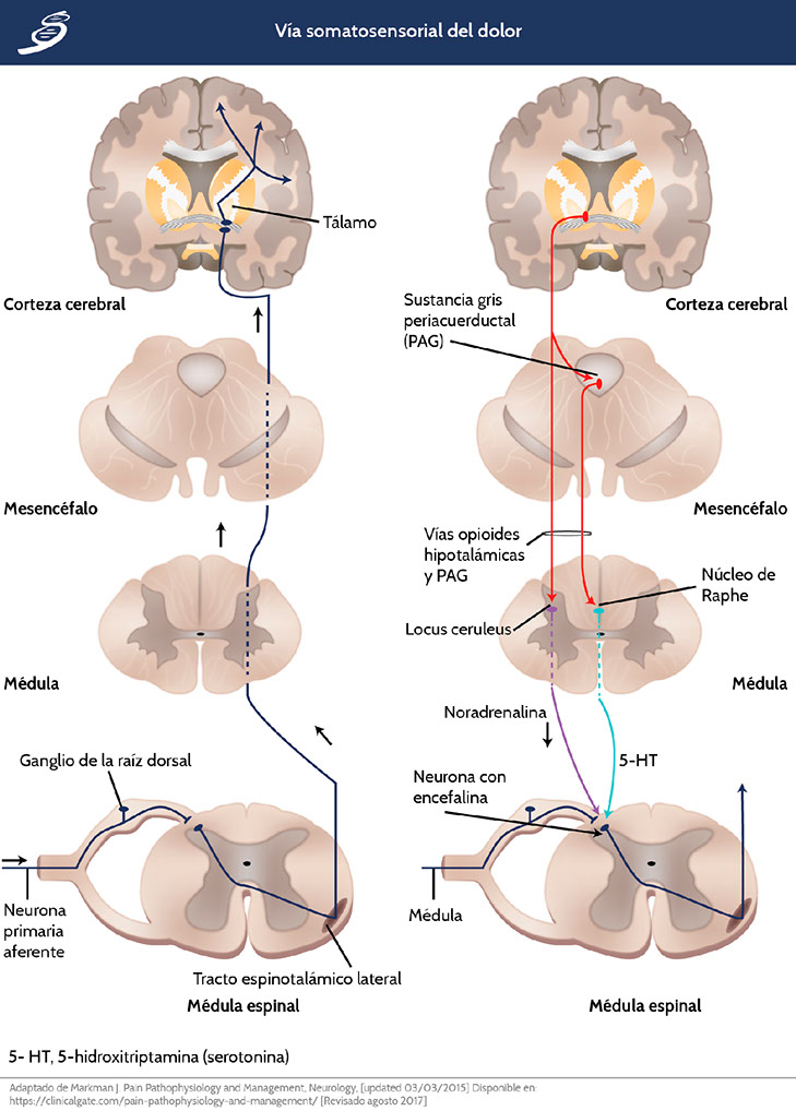 Neuronas en activo y dolor