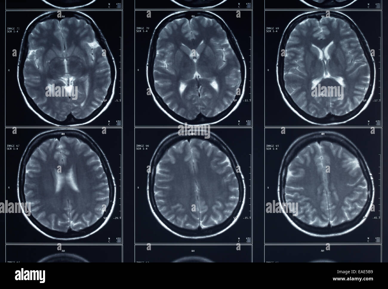 Una radiografía del cerebro